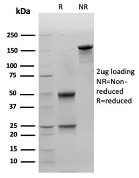 LGALS3 Antibody