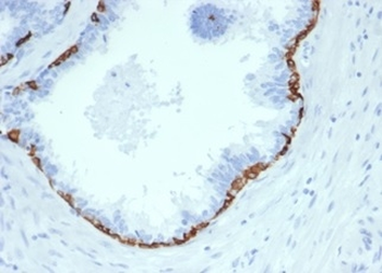 KRT14 Antibody