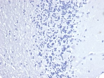 KRT14 Antibody