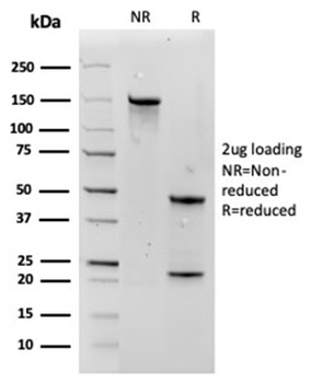 AQP4 Antibody