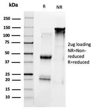 GTF2B Antibody