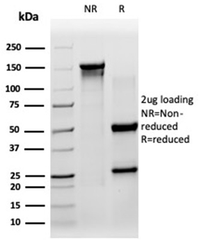 SIRT3 Antibody