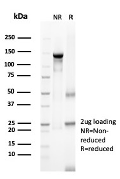 Nectin 4 / Nectin Cell Adhesion Molecule 4 / PVRL4 Antibody