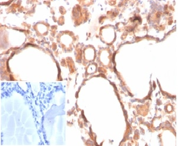 CALCA Antibody