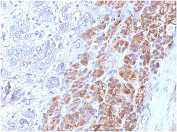 IL25 Antibody