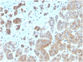 IL1B Antibody