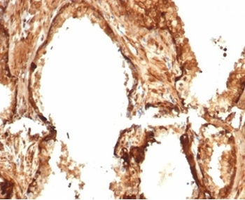 HSPB1 Antibody