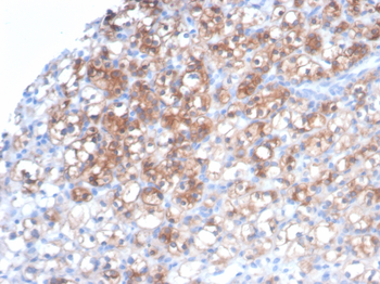 HSPB1 Antibody