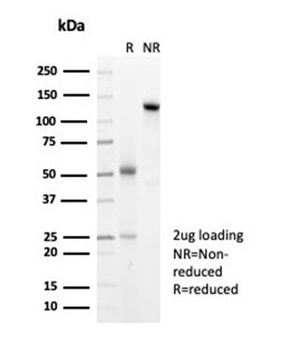 HSPB1 Antibody