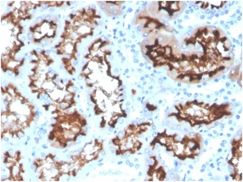 ACE Antibody