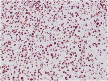 SMARCB1 Antibody