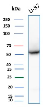 Recombinant Vimentin (Mesenchymal Cell Marker) Antibody