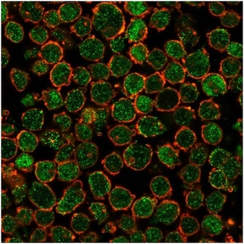 CHEK2 Antibody
