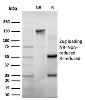 CHEK2 Antibody