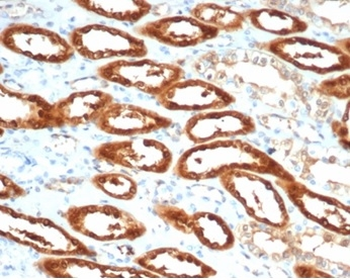 CKB Antibody