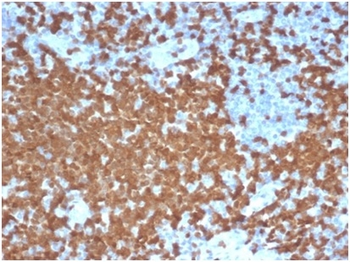 ZAP70 Antibody