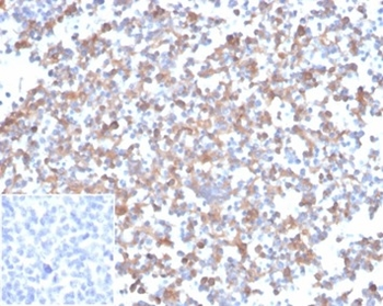 SPARC / Osteonectin Antibody