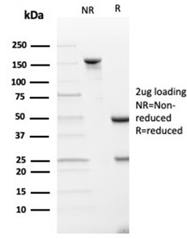 SPARC / Osteonectin Antibody
