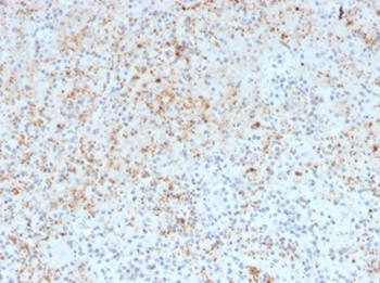 SPARC / Osteonectin Antibody