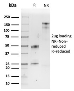 SPARC / Osteonectin Antibody