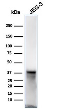 SPARC / Osteonectin Antibody