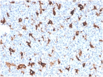 SPARC / Osteonectin Antibody