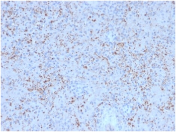 SPARC / Osteonectin Antibody