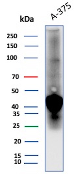 SPARC / Osteonectin Antibody