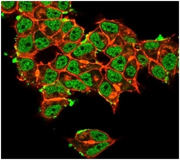 SOD1 Antibody