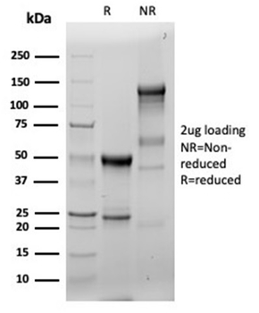 FSCN1 Antibody