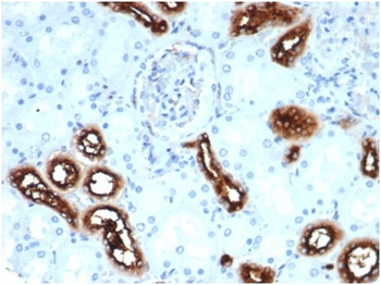 FSCN1 Antibody