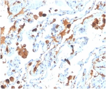 SFTPD Antibody