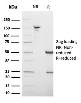 S100B Antibody