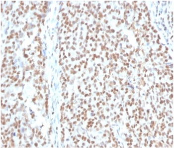 RPA2 Antibody