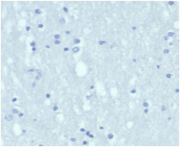 KRT7 Antibody