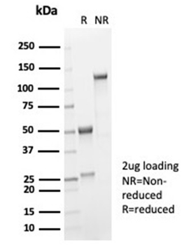 Recombinant Interleukin-2 (IL-2) Antibody