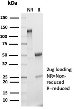 Recombinant Interleukin-2 (IL-2) Antibody