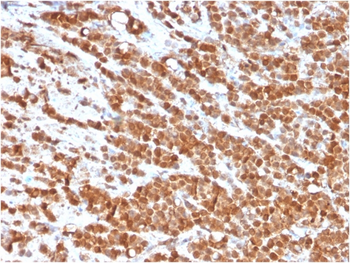 Interleukin-2 (IL-2) Antibody