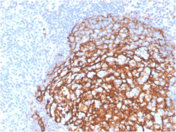 Recombinant CD21 (Mature B-Cell & Follicular Dendritic Cell Marker) Antibody