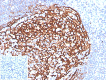 Recombinant CD21 (Mature B-Cell & Follicular Dendritic Cell Marker) Antibody