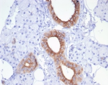 CFTR Antibody