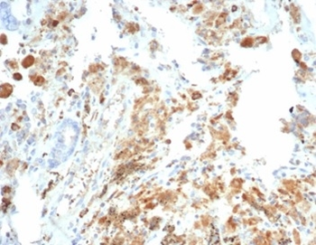 CFTR Antibody