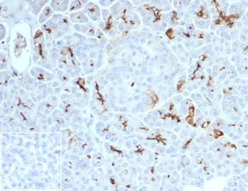 CFTR Antibody