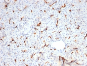 CFTR Antibody