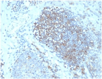 Fas Ligand (FASLG) Antibody