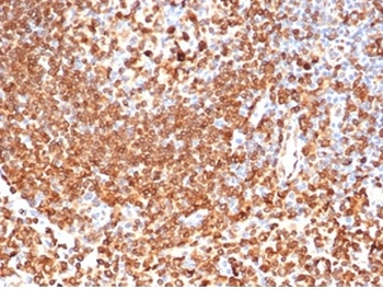 CD74 Antibody