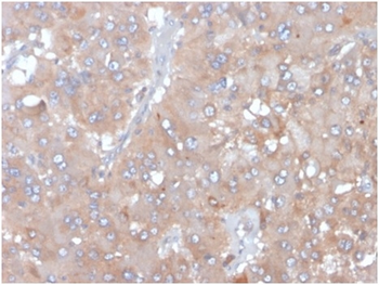 IL5 Antibody