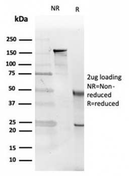 IL5 Antibody