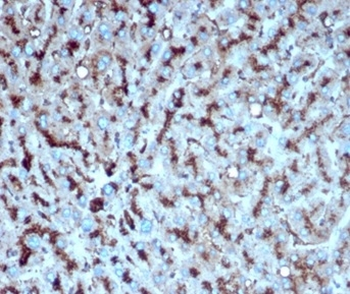 CTSD Antibody