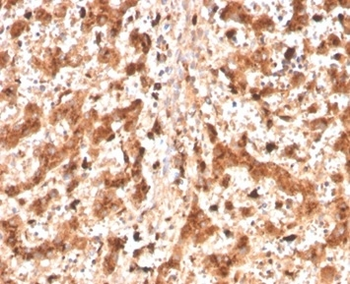 CTSD Antibody